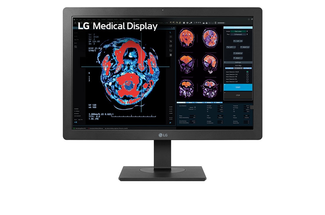 LG 24” 2MP IPS Clinical Review Monitor, front view, 24HR513C-B