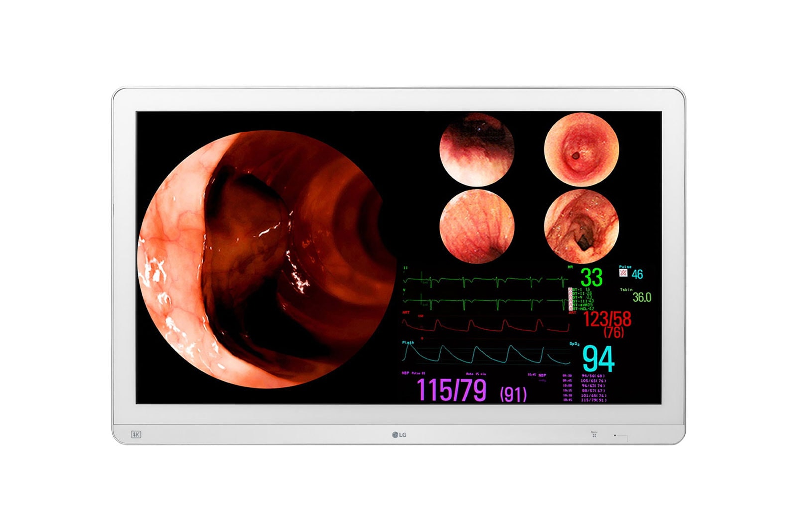 LG Monitor cirúrgico IPS 4K de 32'' (3840 x 2160), suporte a até 4PBP, PIP e HDR10, à prova de poeira, resistente à água., 32HL710S-W