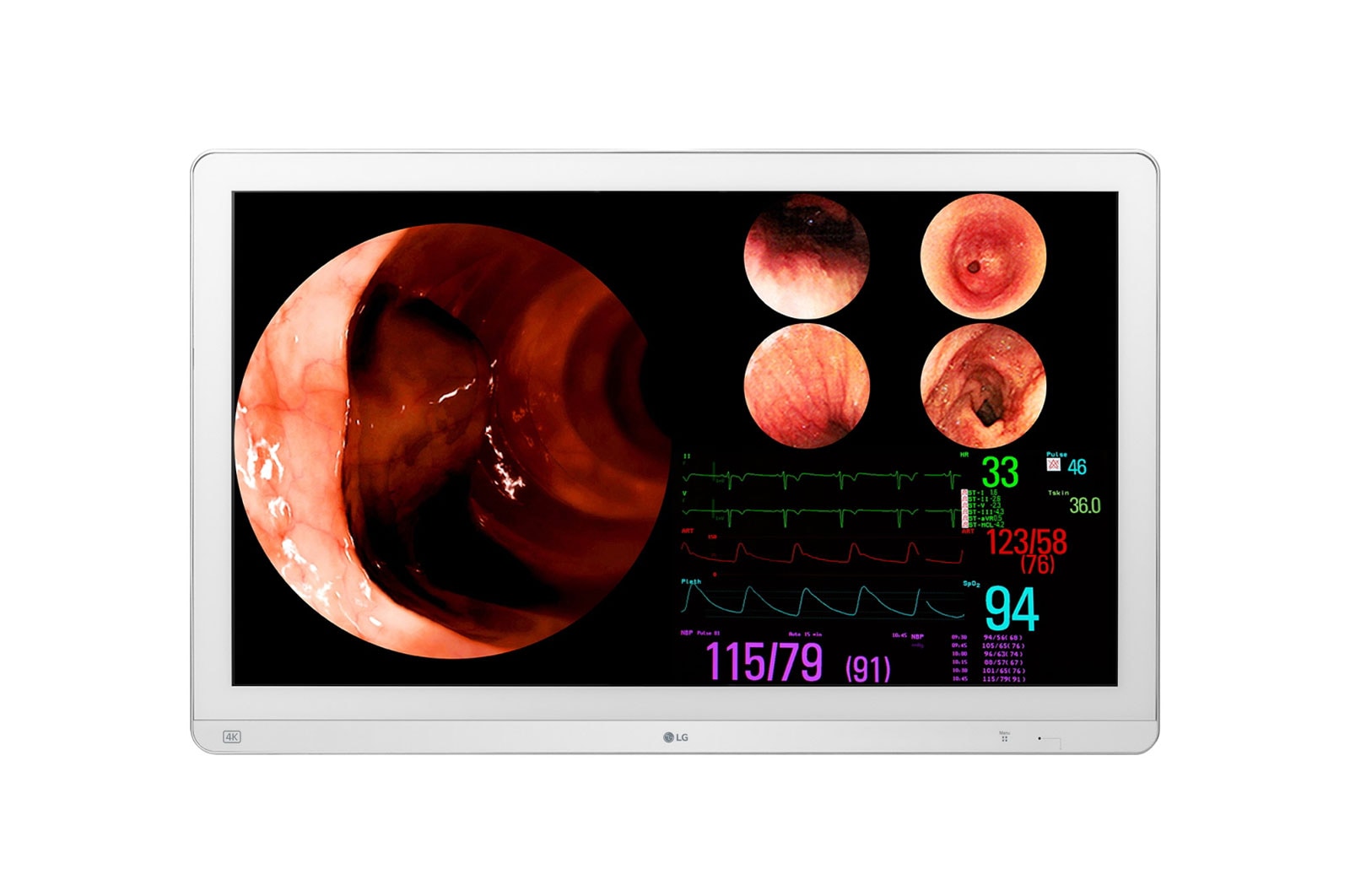 LG Monitor cirúrgico IPS 4K de 32'' (3840 x 2160), suporte a até 4PBP, PIP e HDR10, à prova de poeira, resistente à água., 32HL714S-W