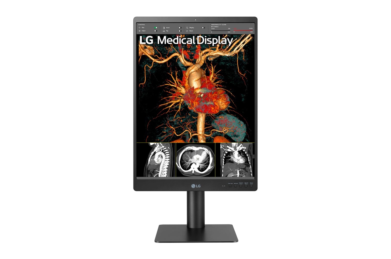 LG Monitor de diagnóstico LG IPS 21,3'' 3 MP, 21HQ513D-B