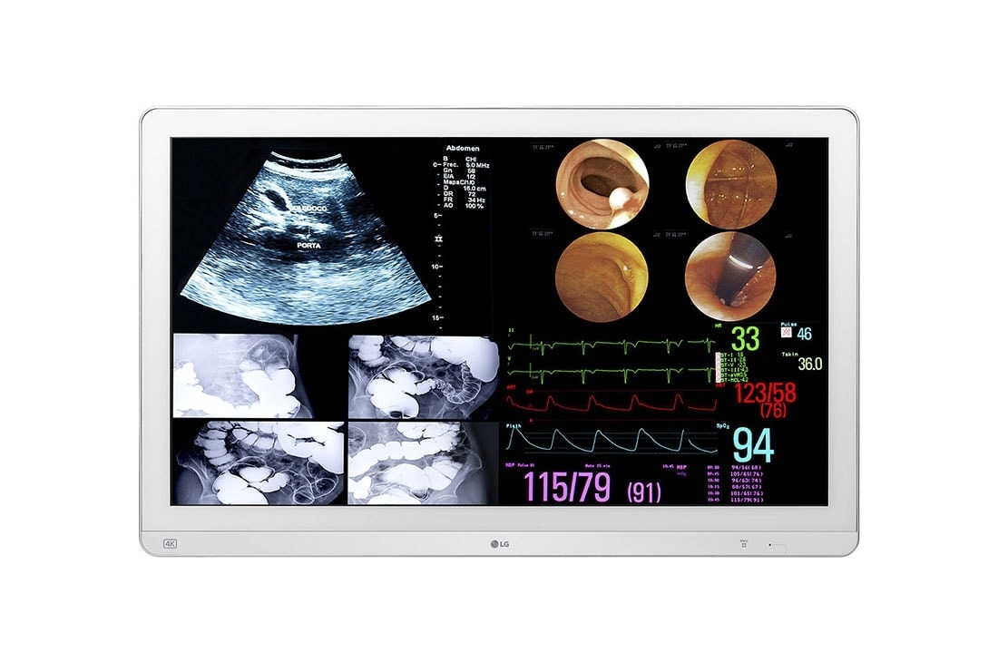 LG kirurgiline monitor 32HL714S – 31,5-tolline 4K IPS / HDR10 tugi / 12G-SDI tugi / kuni 4PBP, PIP / avariilülituse sisendi lüliti / peegel- ja pöörlemisrežiim , Eestvaade, 32HL714S-W
