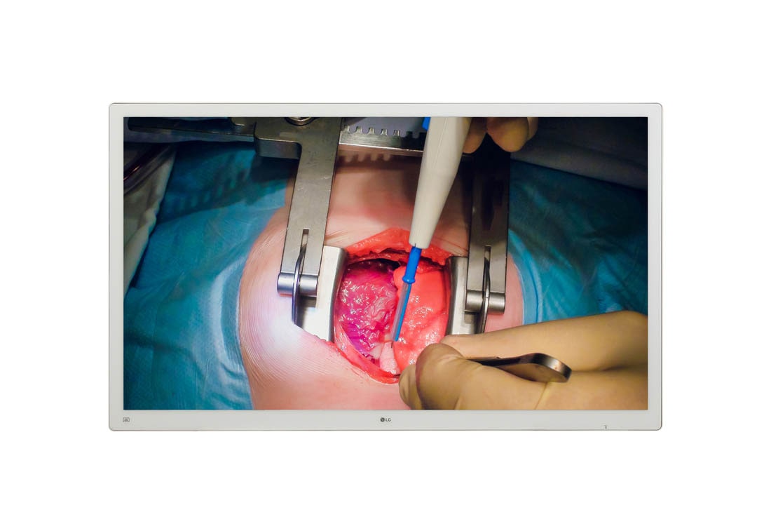 LG Χειρουργική οθόνη 55'' 4K IPS της LG, Μπροστινή όψη με εικόνα που γεμίζει το χώρο, 55MH5K-W
