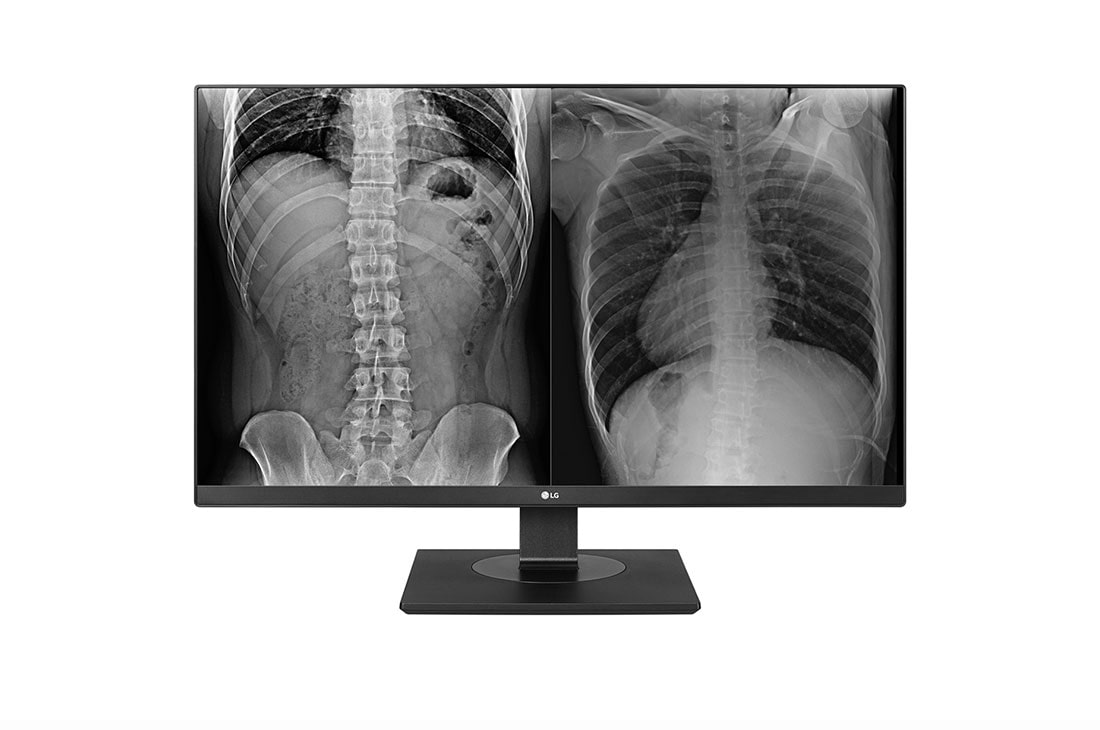 LG Monitor de evaluare clinică LG 8MP, Front view, 27HJ713C-B