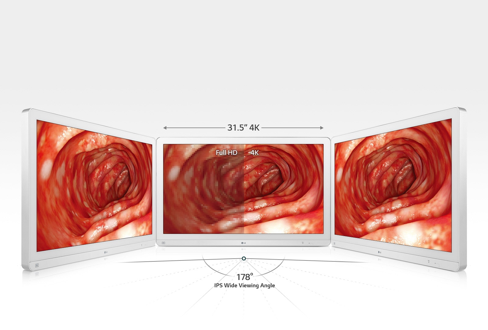 Accuracy with Wide Viewing1
