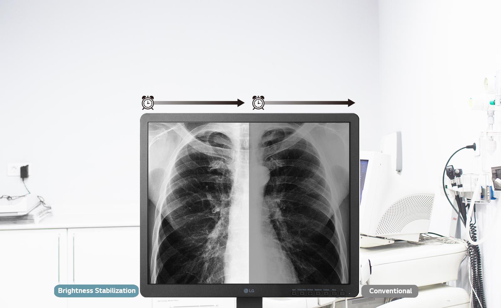 Brightness Stabilization1