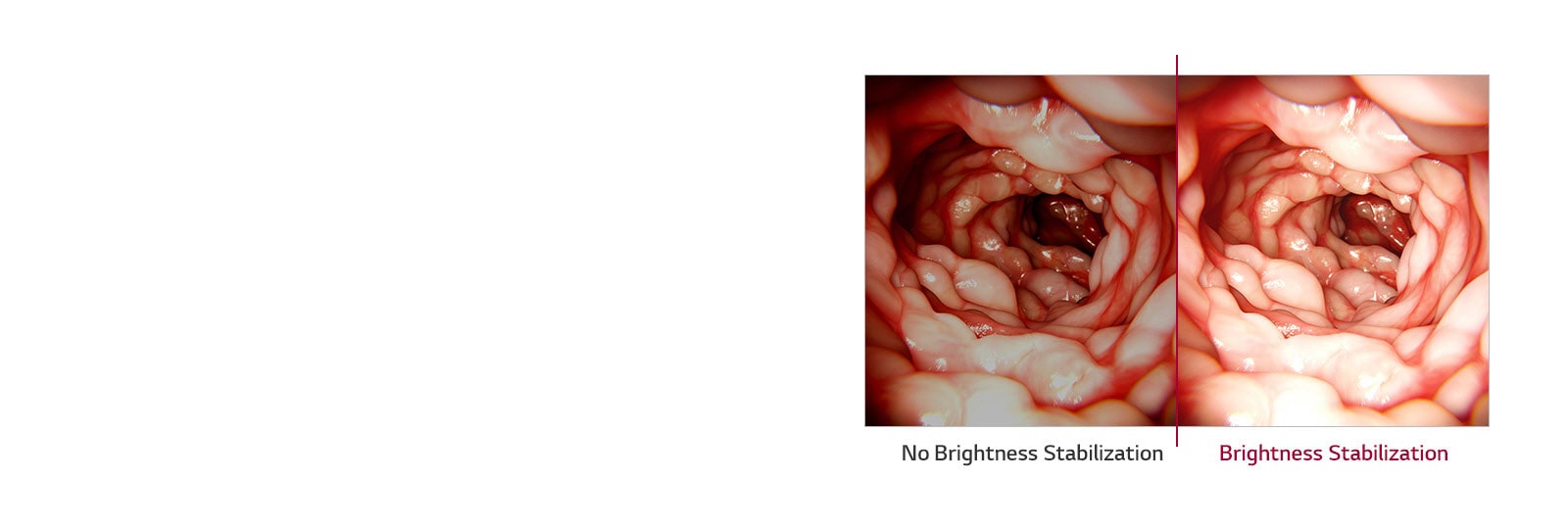 Brightness Stabilization1