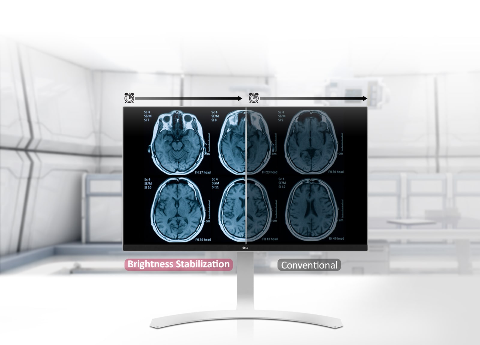 Brightness Stabilization1