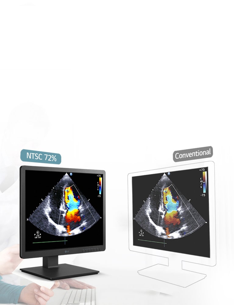 330nits & NTSC 72% Precise Resolution2