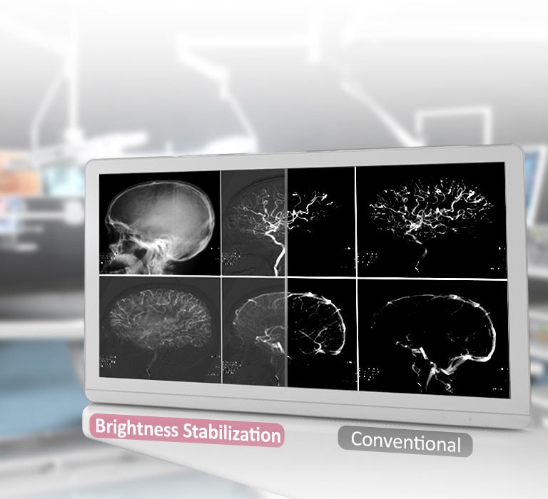 DICOM Part 14 & Brightness Stabilization2