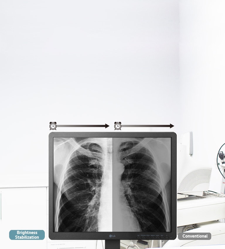 Brightness Stabilization2