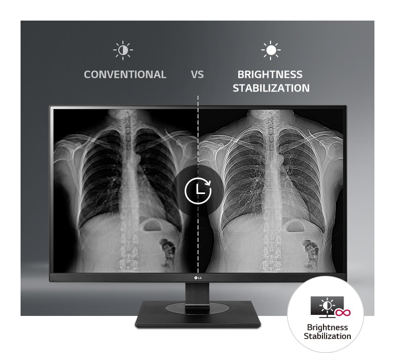 Consistently Stable Display2