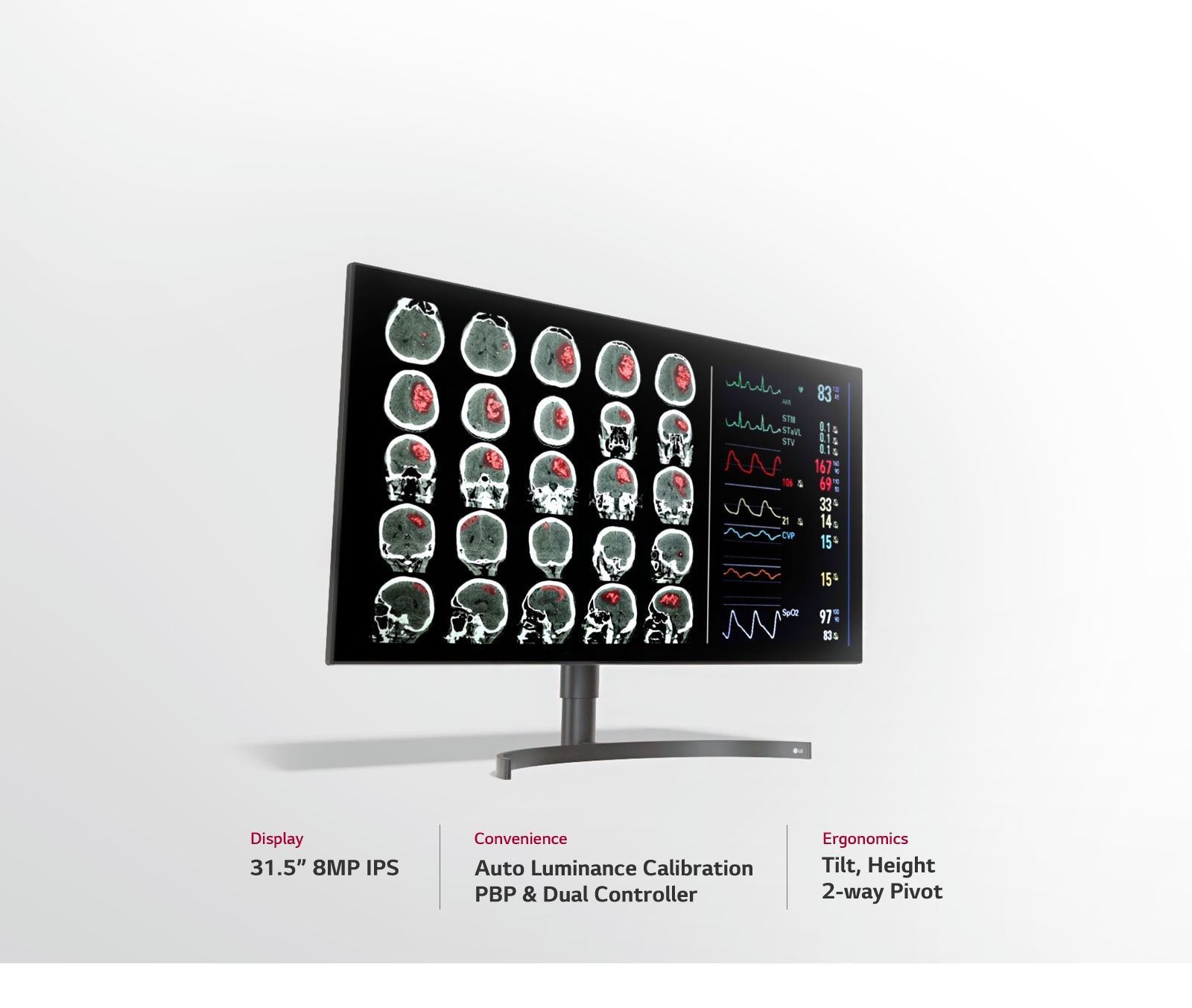 31.5” 8MP Diagnostic Monitor3