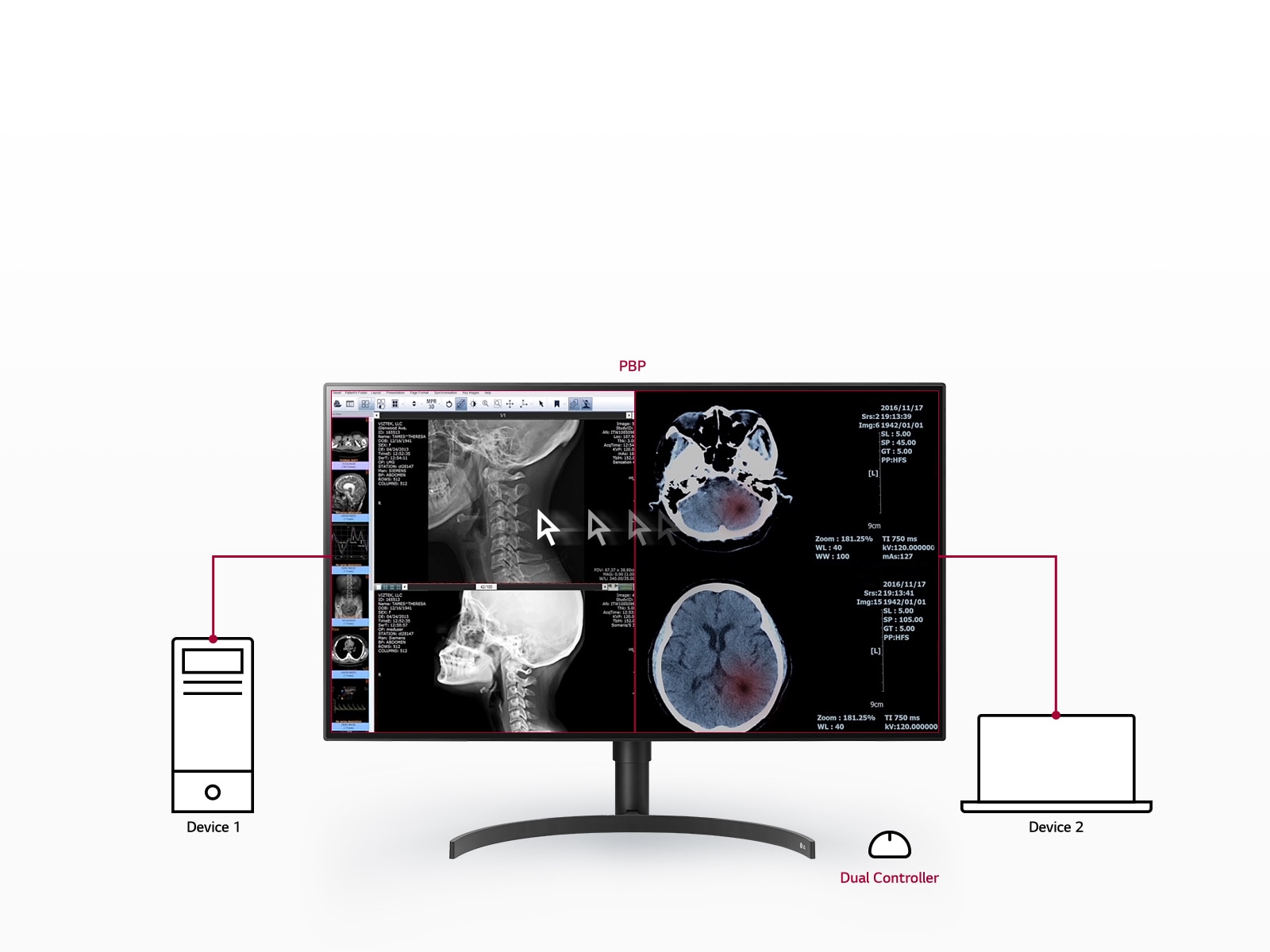 Multiple Signals on One Screen1