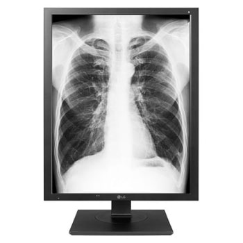 21.3” High Brightness (2048 x 1536) 3MP IPS Clinical Review Monitor1