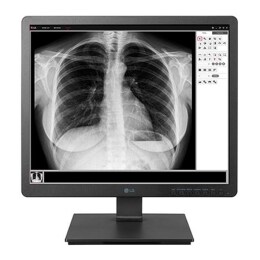 19" 1.3 MP Clinical Review Monitor2