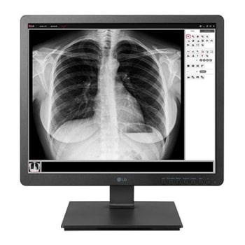 19" 1.3 MP Clinical Review Monitor1