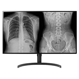 31.5'' 8MP (3840x2160) IPS Medical Imaging Diagnostic Monitors2