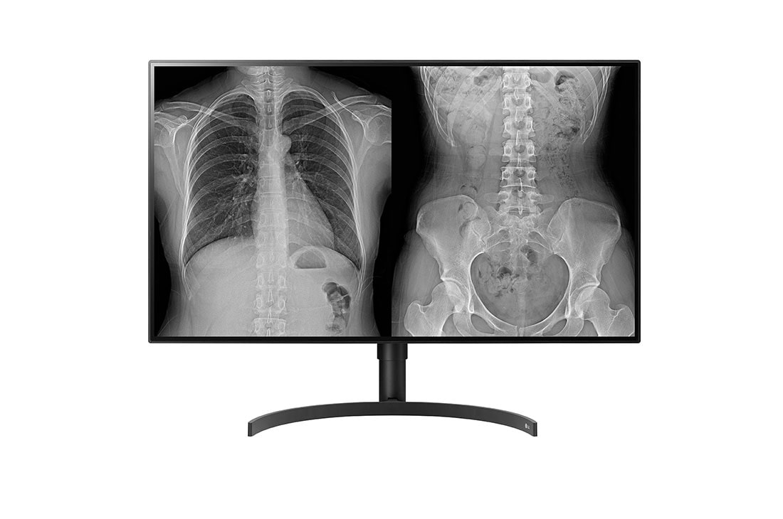 LG 31.5'' 8MP (3840x2160) IPS Medical Imaging Diagnostic Monitors, 32HL512D-B