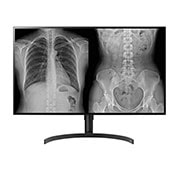 LG 31.5'' 8MP (3840x2160) IPS Medical Imaging Diagnostic Monitors, 32HL512D-B, thumbnail 1