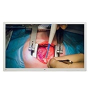LG New LG 55'' 4K (3840x2160) IPS Surgical Monitor, 2024, Front view with infill image, 55MH5K-W, thumbnail 1