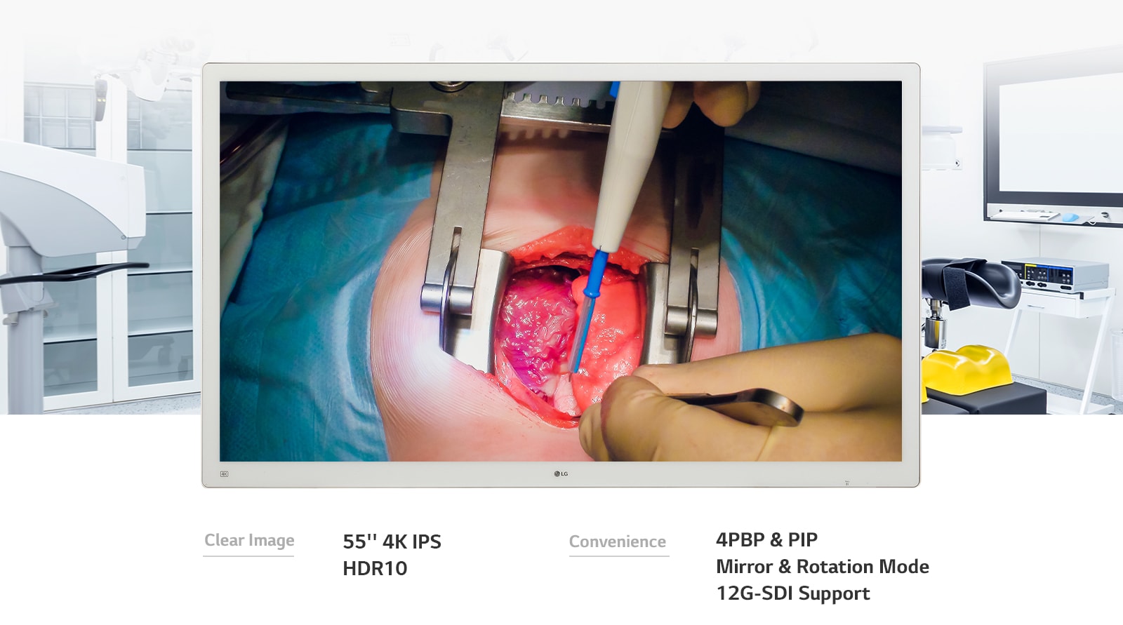 LG’s 55-inch 4K IPS Surgical Monitor 55MH5K will take your image quality and convenience to the next level.