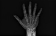 x-ray image 6.