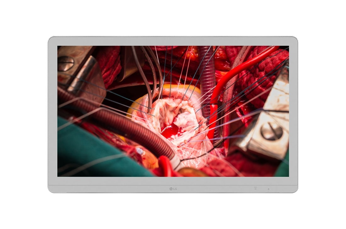 LG 27'' UHD 8MP Surgical Monitor, 27HJ710S-W, thumbnail 0