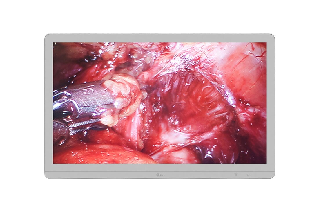 LG 27'' UHD 8MP Surgical Monitor, 27HJ710S-W, thumbnail 2