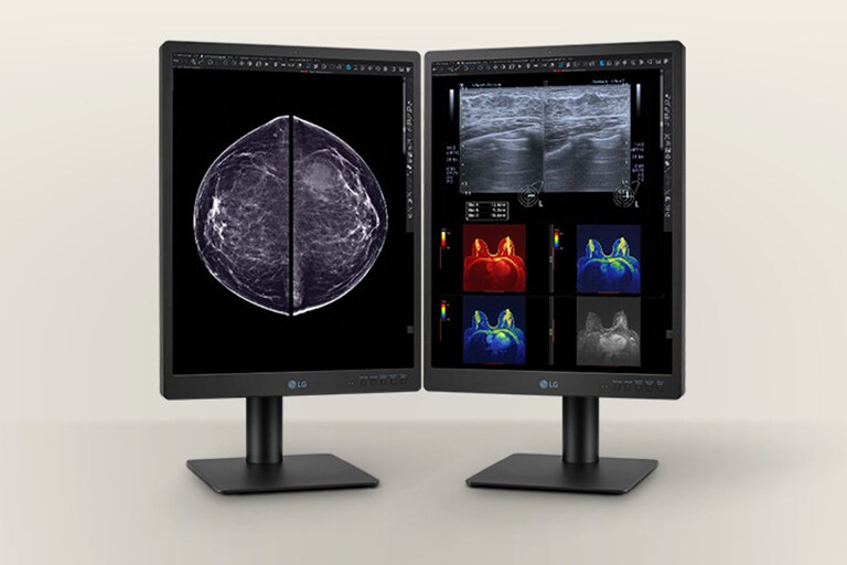 Diagnostic Monitor 21HQ613D displays radiological images, including full field digital mammography and digital breast tomosynthesis, with a brightness of 1,100 cd/m² and a contrast ratio of 1,800:1.	