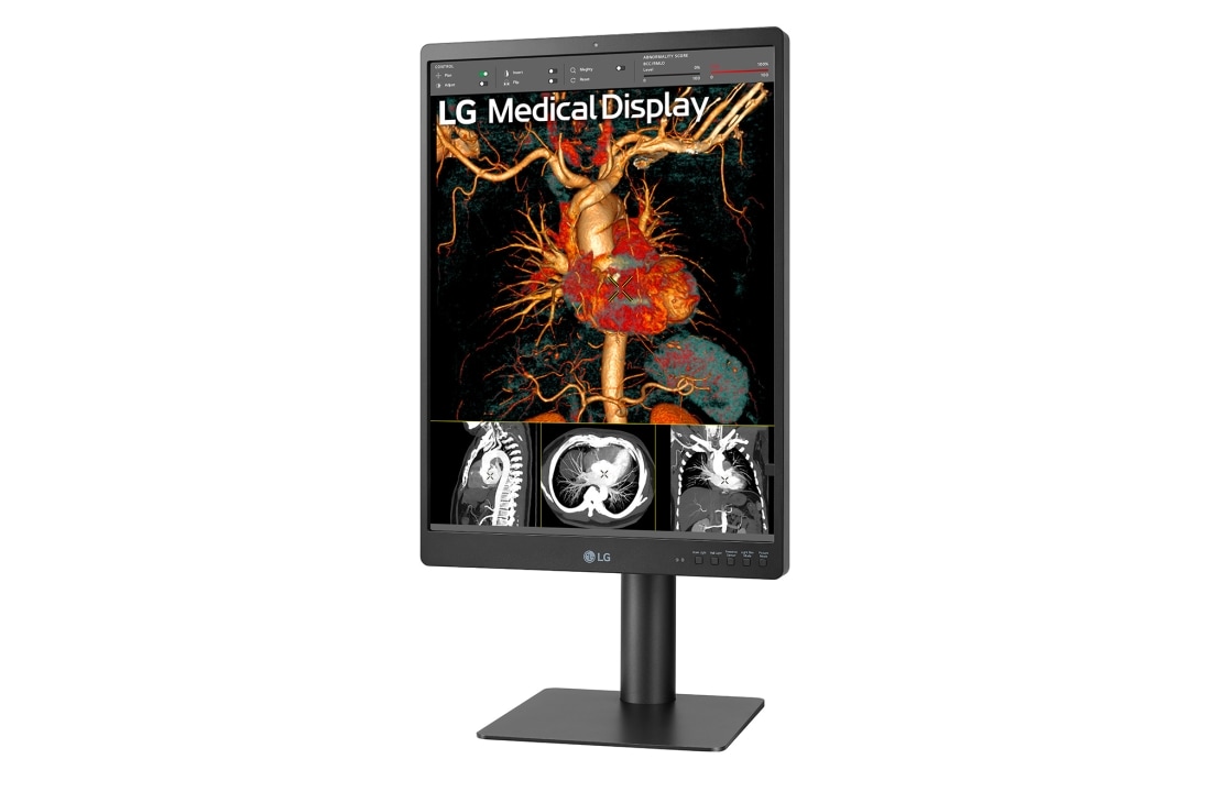 LG 21.3'' 3MP IPS Diagnostic Monitor, -15 degree side view, 21HQ513D-S, thumbnail 3