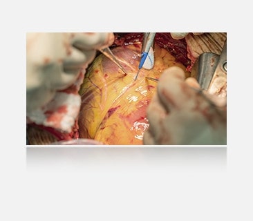 The right image, with anti-reflection coating, offers a clearer view with reduced glare.	