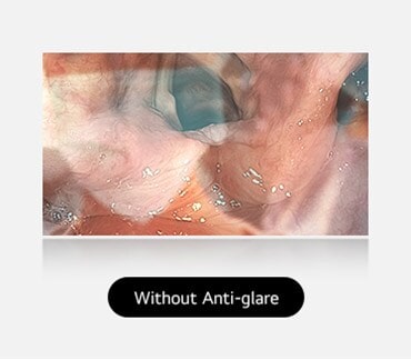 The left image shows a display without anti-glare, where reflections and glare obscure the view.	