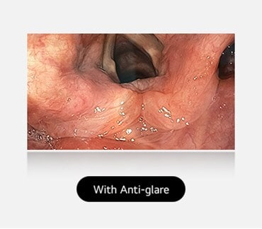 The right image, with anti-glare coating, provides a clear and unobstructed view, demonstrating the effectiveness of the coating.	