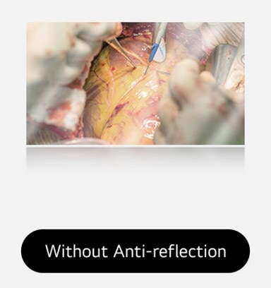 The left image shows a display without anti-reflection, with more glare and reflections affecting visibility. 	