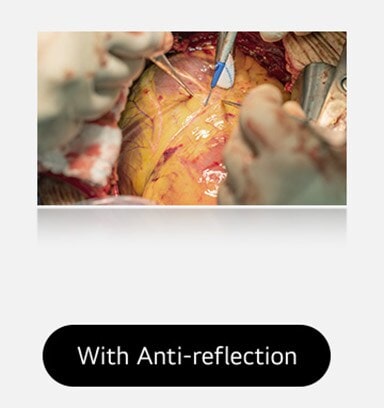 The right image, with anti-reflection coating, offers a clearer view with reduced glare.	