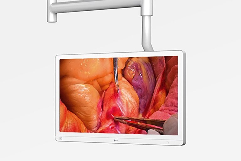 The image shows a 8.8kg lightweight medical display mounted on a ceiling, displaying a surgical procedure.