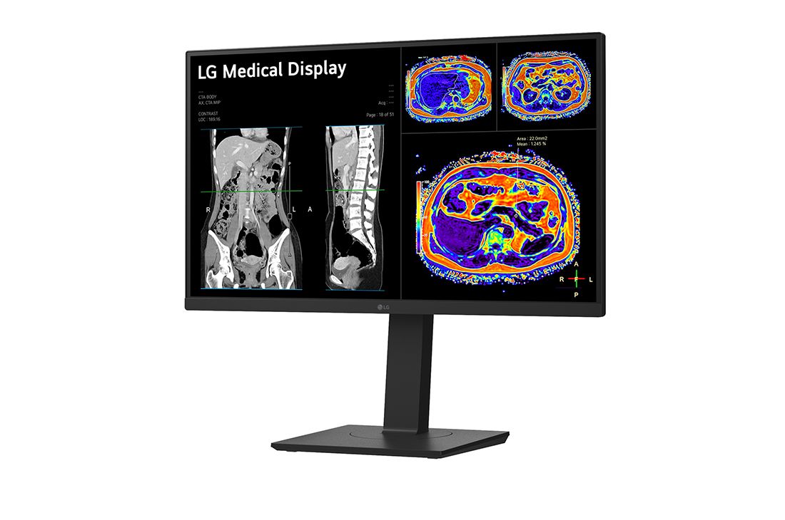 LG 27'' LG 8MP IPS Clinical Review Monitor, Focus View Mode, Dual Controller & KVM Switch, -15 degree side view, 27HS713C-B, thumbnail 2