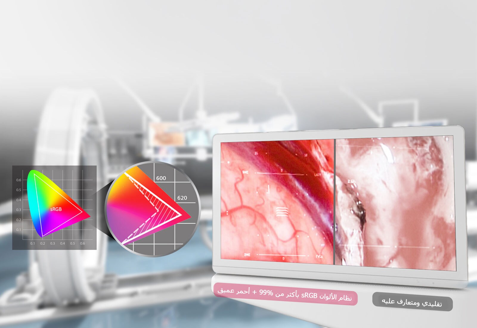 IPS و115 بنظام ألوان sRGB تحسين الأحمر القاتم1