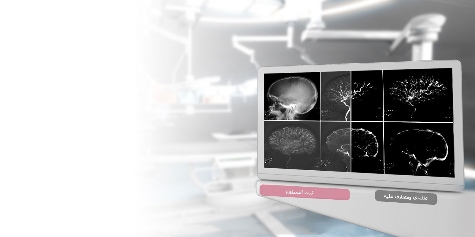 معيار DICOM الجزء 14<br>ثبات السطوع1