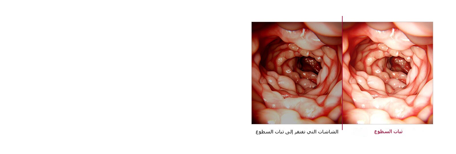 ثبات السطوع1