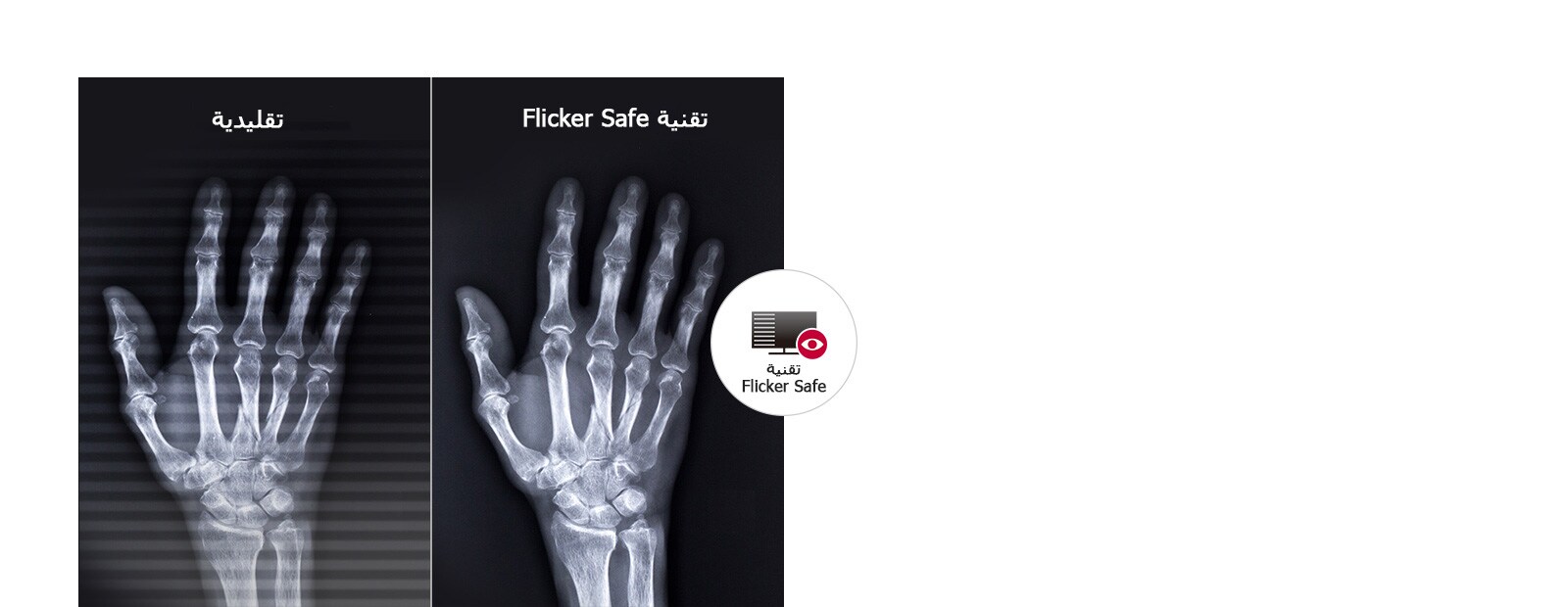 D05_D08_Medical-MNT-27HJ713C-05-Flicker-Safe-Desktop_1557837834783_1579243149715