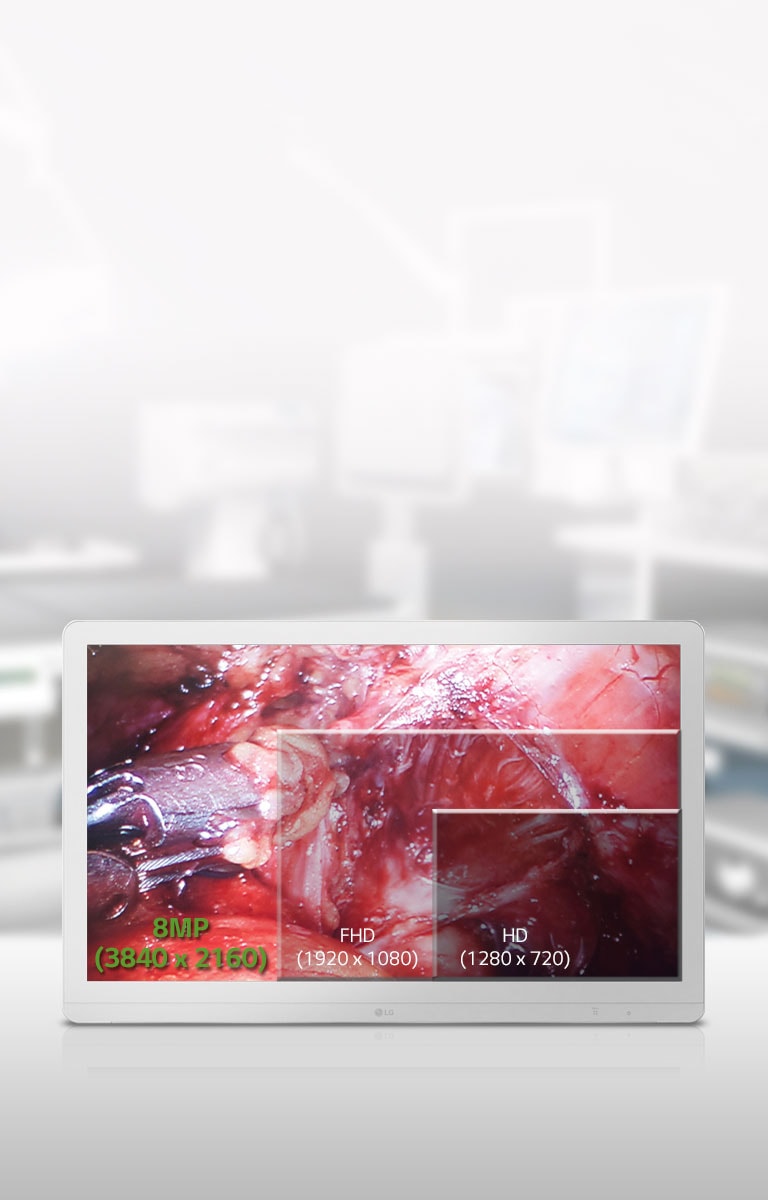 عرض أمثل لغرفة العمليات2