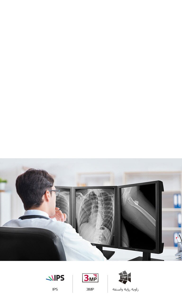 جودة صورة دقيقة2