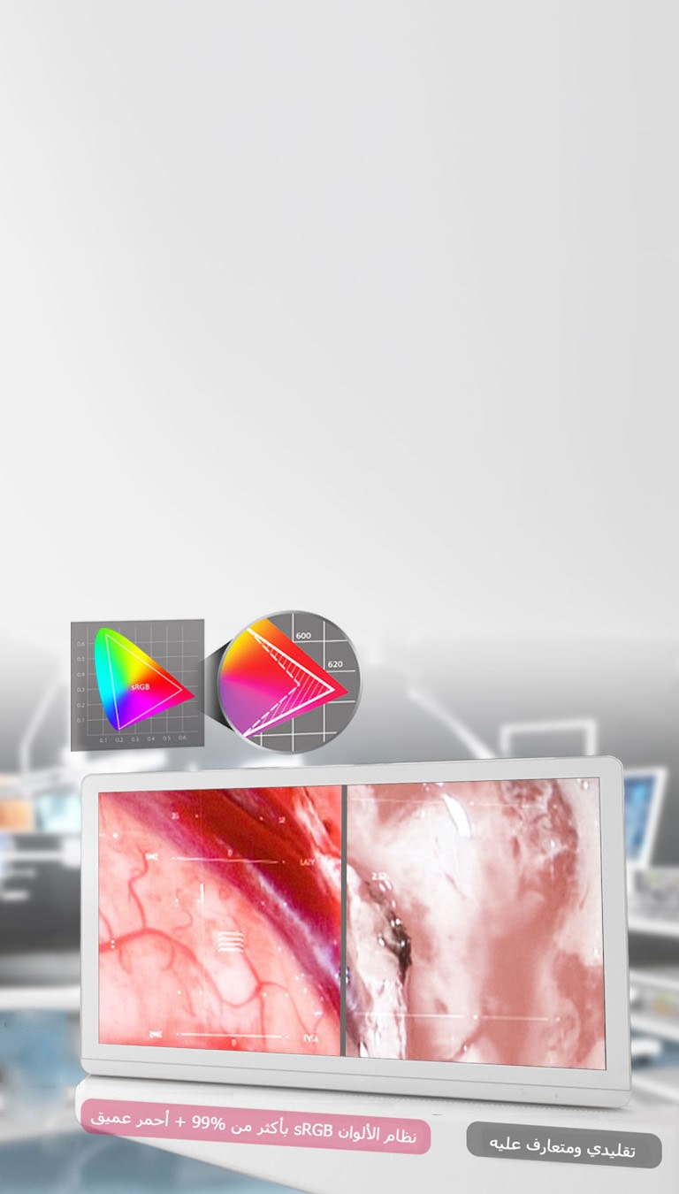 IPS و115 بنظام ألوان sRGB تحسين الأحمر القاتم2