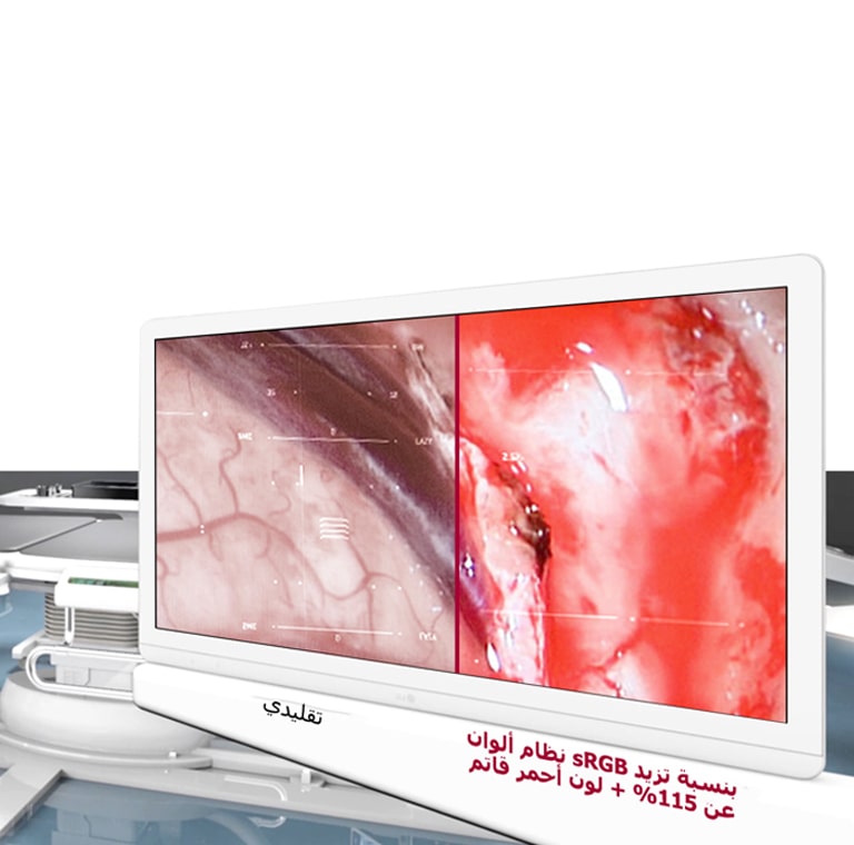 جودة صورة مثالية2