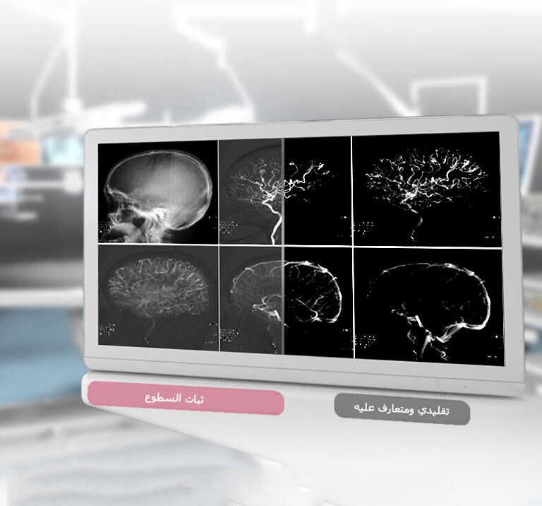معيار DICOM الجزء 14<br>ثبات السطوع2