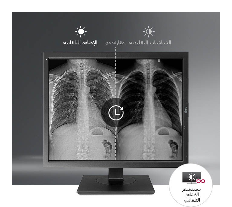 الشاشات التي تتميز بالسطوع التلقائي2