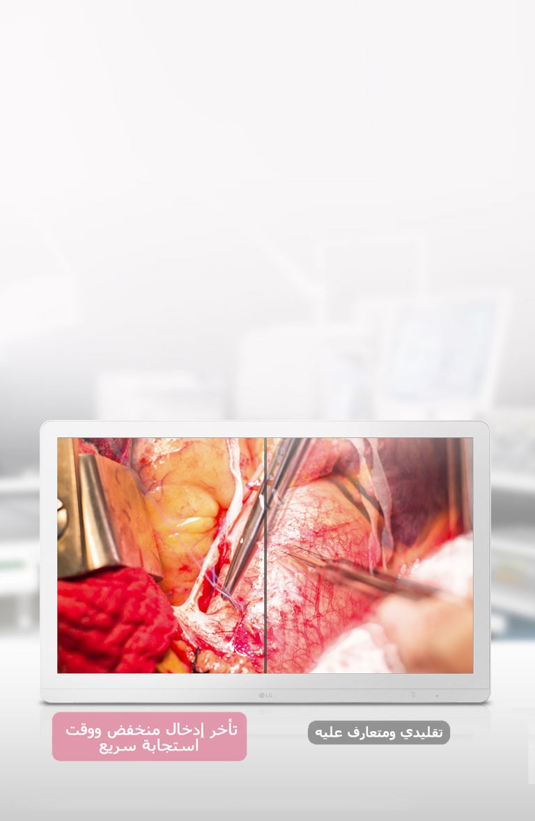 الوقاية من الاهتزاز2