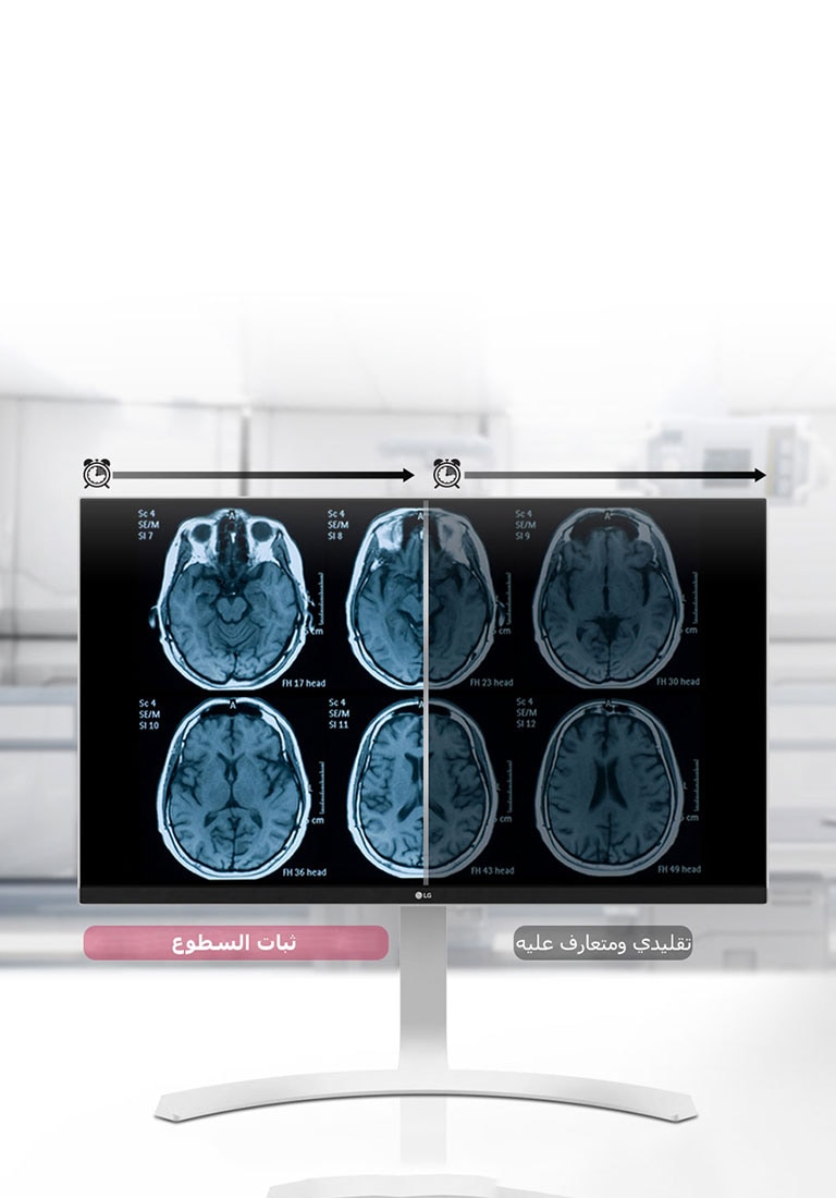 ثبات السطوع2