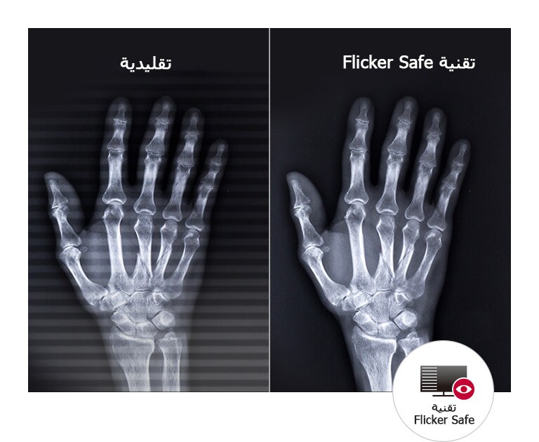 راحة مستمرة للعين2